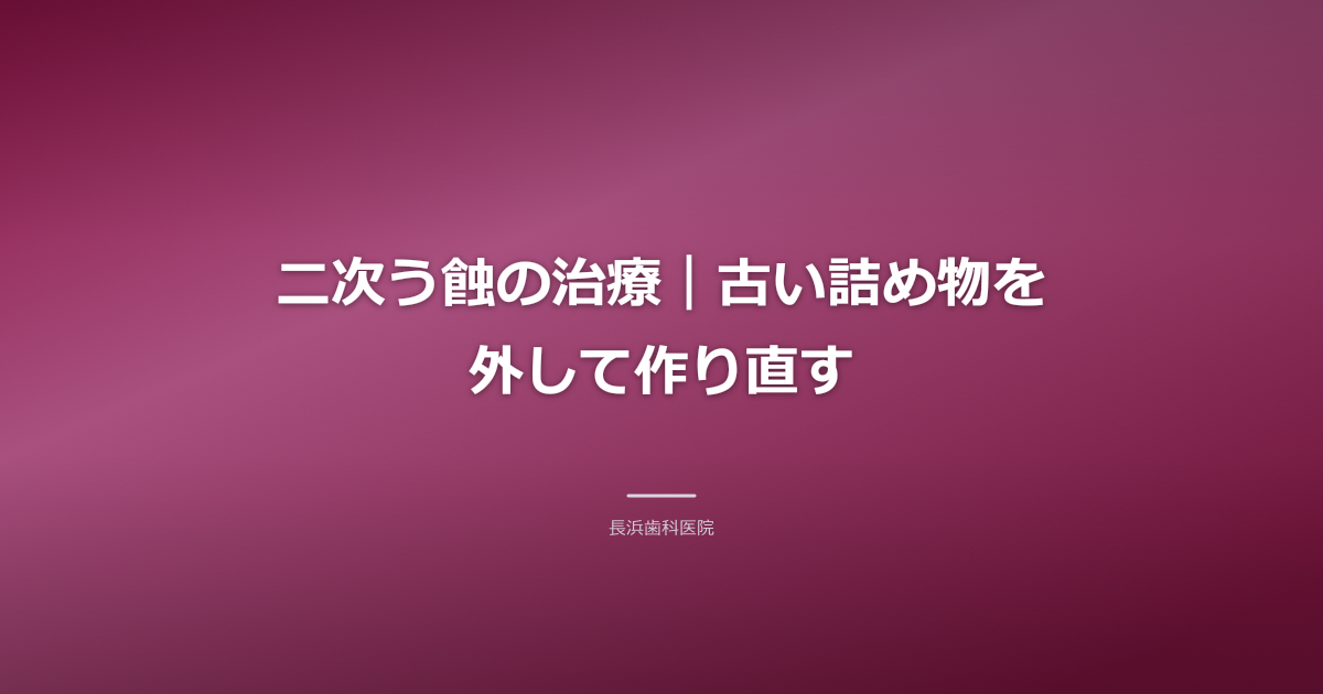 歯科医が虫歯を除去し、新しい詰め物を準備している様子