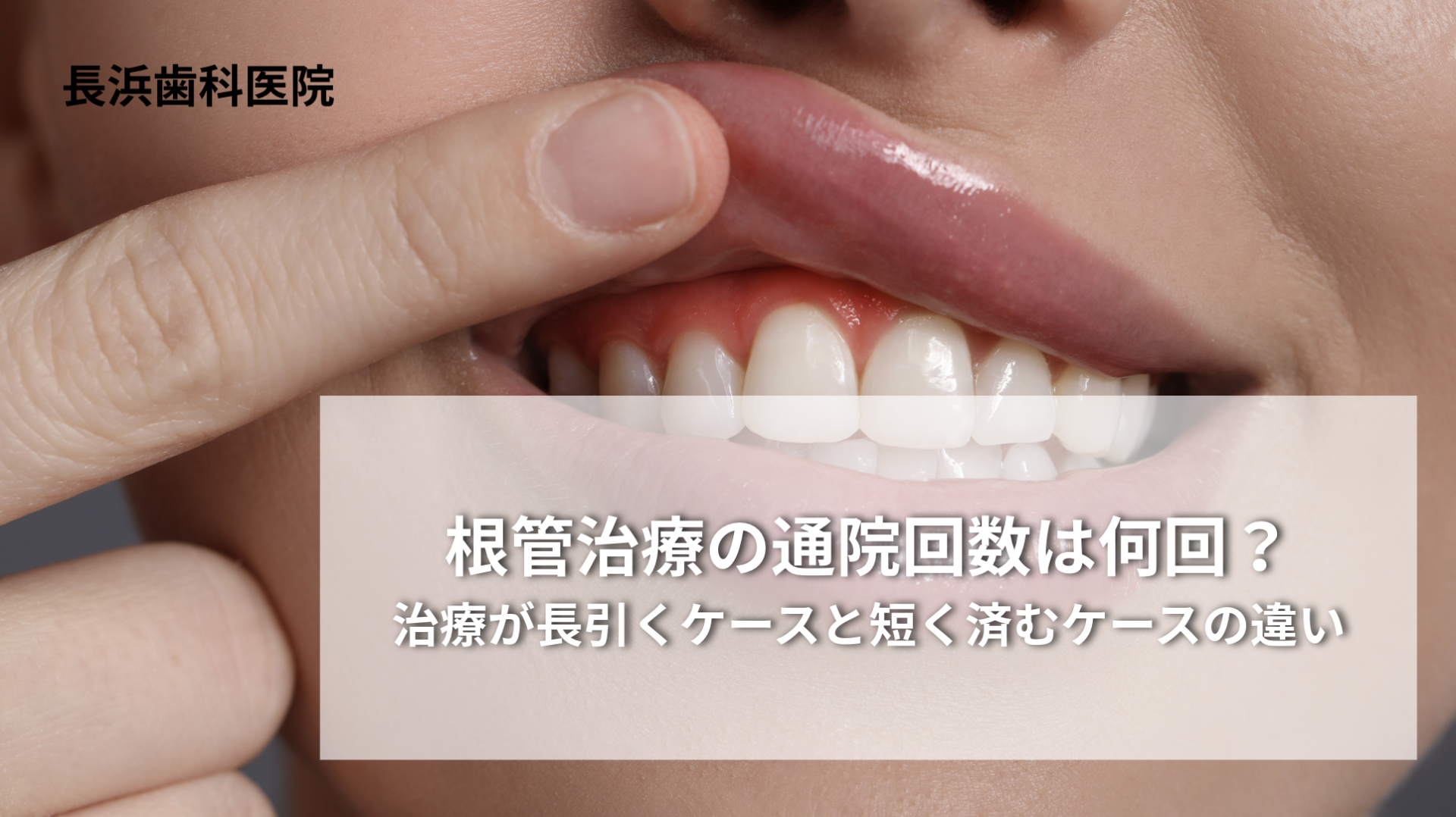 根管治療の通院回数は何回？治療が長引くケースと短く済むケースの違い
