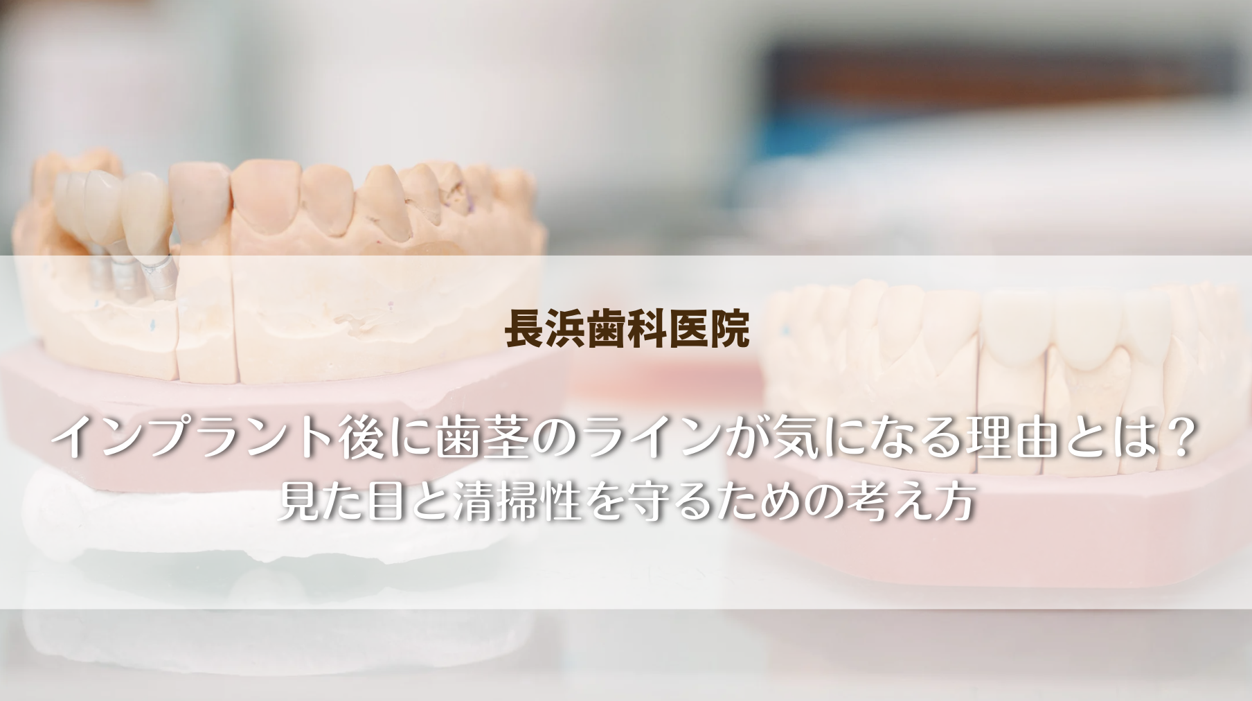 インプラント後に歯茎のラインが気になる理由とは?見た目と清掃性を守るための考え方
